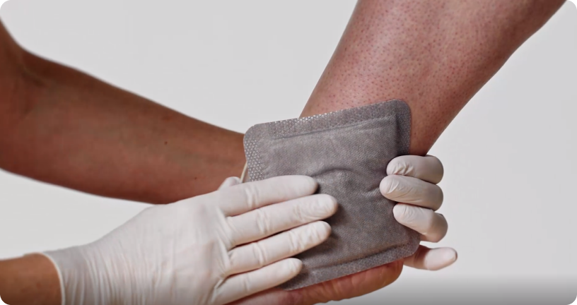 Anvendelse af den superabsorberende sårbandage - Størrelse: 7,5 cm x 7,5 cm