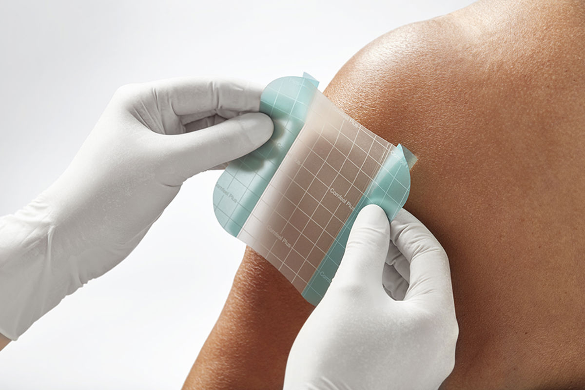 Hvordan vælger jeg den rigtige hydrokolloidbandage?